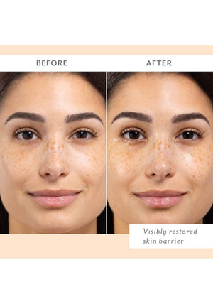 Patchology Skin Remedy 4 Pack Barrier-Boosting Sheet Mask