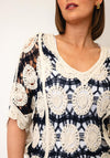 TSC TOP